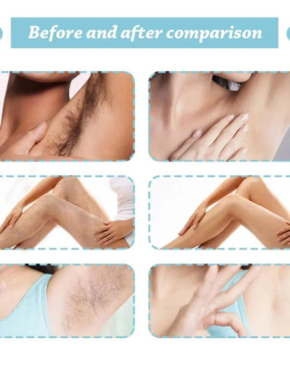 Before and after comparison of hair removal spray for men and women on various body areas